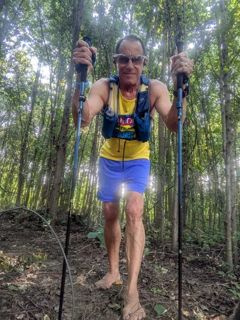 An athletic person using trekking poles while walking barefoot in a wooded area. An athletic person using trekking poles while walking barefoot in a wooded area.